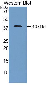 Polyclonal Antibody to Regulated On Activation In Normal T-Cell Expressed And Secreted (RANTES)