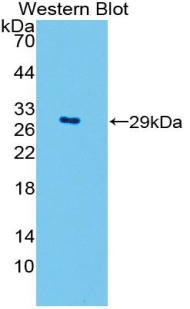 Polyclonal Antibody to Superoxide Dismutase 3, Extracellular (SOD3)