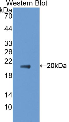 Polyclonal Antibody to Cluster Of Differentiation 30 Ligand (CD30L)