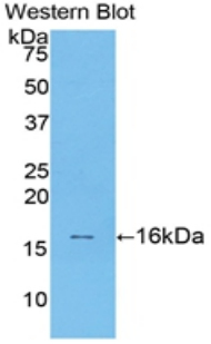 Polyclonal Antibody to Transforming Growth Factor Beta 1 (TGFb1)