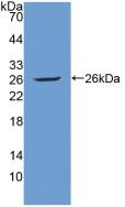 Polyclonal Antibody to Tyrosine Kinase With Immunoglobulin Like And EGF Like Domains Protein 1 (Tie1)