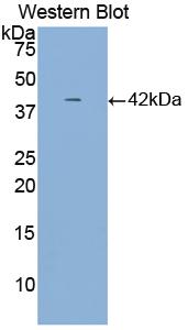 Polyclonal Antibody to Alpha-2-Heremans Schmid Glycoprotein (AHSG)