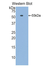 Polyclonal Antibody to Laminin Beta 1 (LAMb1)