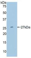 Polyclonal Antibody to Matrix Metalloproteinase 11 (MMP11)