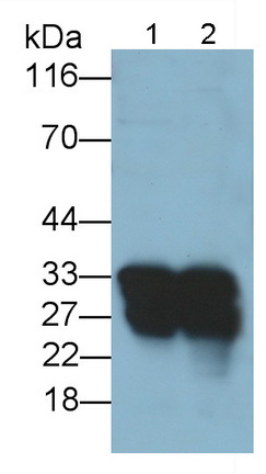 Polyclonal Antibody to Protease, Serine 1 (PRSS1)