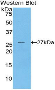 Polyclonal Antibody to Phospholipase C Gamma 1 (PLCg1)