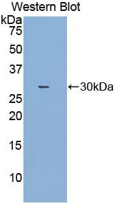 Polyclonal Antibody to Nitric Oxide Synthase Interacting Protein (NOSIP)