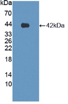 Polyclonal Antibody to Latrophilin 3 (LPHN3)
