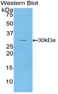 Polyclonal Antibody to Phosphoinositide-3-Kinase Class-2-Alpha Polypeptide (PIK3C2a)