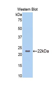 Polyclonal Antibody to Interleukin 23  Subunit Alpha (IL23a)