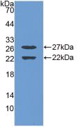 Polyclonal Antibody to Early Growth Response Protein 1 (EGR1)