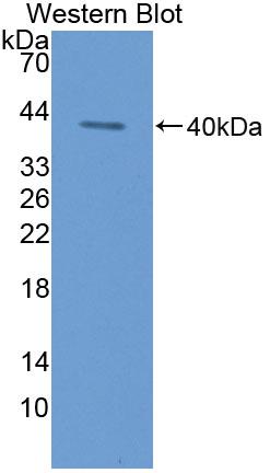 Polyclonal Antibody to Keratin 3 (KRT3)