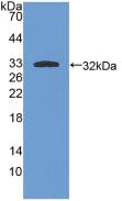 Polyclonal Antibody to Protein Kinase C Iota (PKCi)
