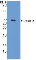 Polyclonal Antibody to Protein Kinase D1 (PKD1)