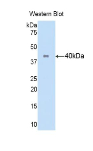 Biotin-Linked Polyclonal Antibody to Cytokeratin 16 (CK16)