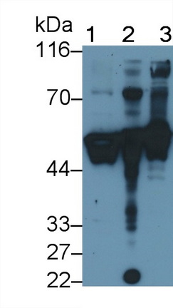 Polyclonal Antibody to Cytokeratin 14 (CK14)