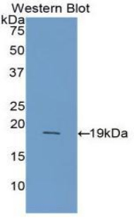 Polyclonal Antibody to Fatty Acid Binding Protein 2, Intestinal (FABP2)