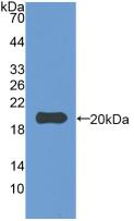 Polyclonal Antibody to Interleukin 1 Beta (IL1b)