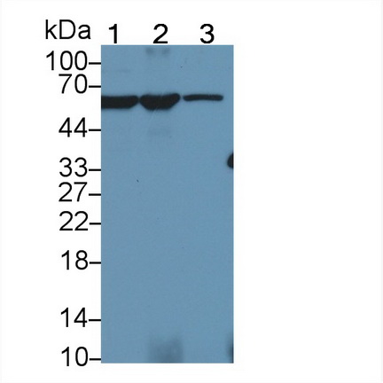 Polyclonal Antibody to Pyruvate kinase isozymes M2 (PKM2)