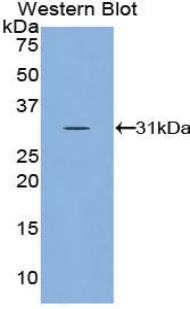 Polyclonal Antibody to Superoxide Dismutase Copper Chaperone