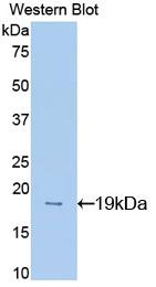 Polyclonal Antibody to Midkine (MK)