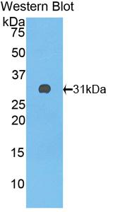 Polyclonal Antibody to Complement Factor H (CFH)