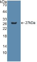 Polyclonal Antibody to Glutathione S Transferase Mu 2 (GSTM2)