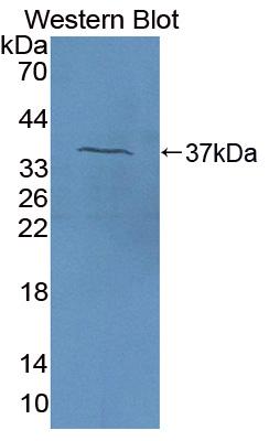 Polyclonal Antibody to Coagulation Factor V (F5)