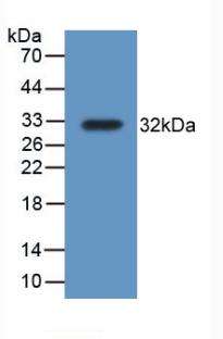 Polyclonal Antibody to Thioredoxin Reductase 1 (TXNRD1)