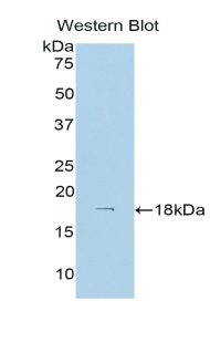 Polyclonal Antibody to Hexokinase 1 (HK1)