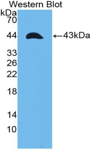 Polyclonal Antibody to Tumor Necrosis Factor Receptor Superfamily, Member 12A (TNFRSF12A)