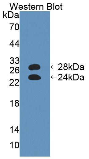 Polyclonal Antibody to Alpha-1-Acid Glycoprotein (a1AGP)