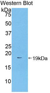 Polyclonal Antibody to Coagulation Factor II (F2)