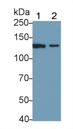 Polyclonal Antibody to Nitric Oxide Synthase 2, Inducible (NOS2)
