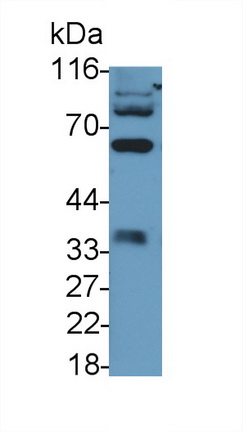 Polyclonal Antibody to Caspase 8 (CASP8)