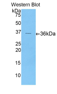 Polyclonal Antibody to Epithelial Neutrophil Activating Peptide 78 (ENA78)
