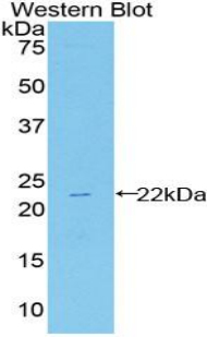 Polyclonal Antibody to Heat Shock Protein Beta 2 (HSPb2)