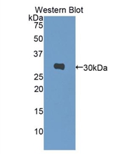 Biotin-Linked Polyclonal Antibody to Carbonic Anhydrase I (CA1)