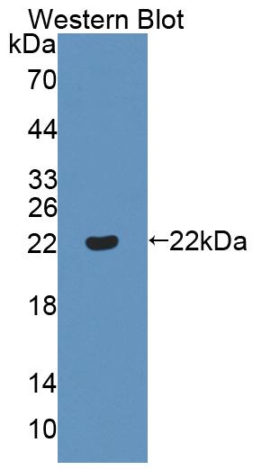 Polyclonal Antibody to Von Willebrand Factor Cleaving Protease (vWFCP)