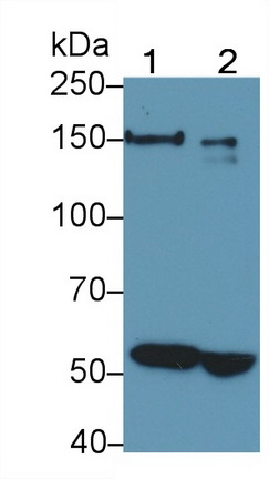 Polyclonal Antibody to L1-Cell Adhesion Molecule (L1CAM)