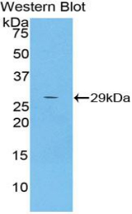 Polyclonal Antibody to Alpha-2-Macroglobulin Like Protein 1 (a2ML1)