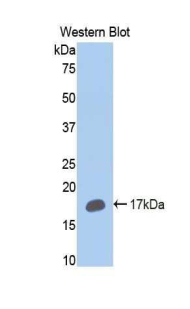 Polyclonal Antibody to Cytochrome P450 2E1 (CYP2E1)