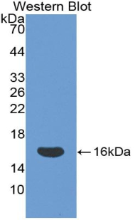 Polyclonal Antibody to Cluster Of Differentiation 160 (C<b>D160</b>)
