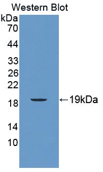 Polyclonal Antibody to Cluster Of Differentiation 160 (CD160)