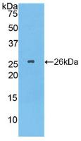 Polyclonal Antibody to Tubulin Polymerization Promoting Protein (TPPP)