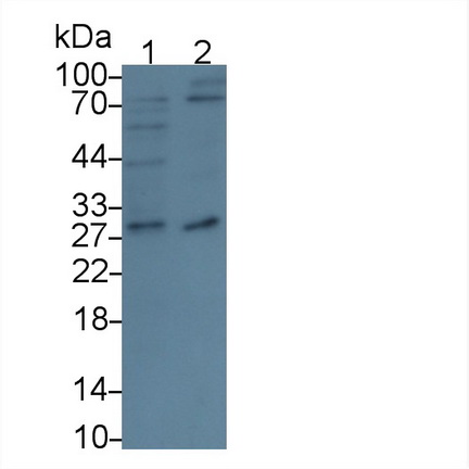 Polyclonal Antibody to Cluster Of Differentiation 320 (C<b>D320</b>)