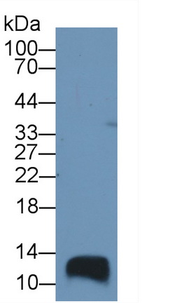 Polyclonal Antibody to Trefoil Factor 1 (TFF1)
