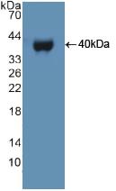 Polyclonal Antibody to Ubiquitin Protein Ligase E3A (UBE3A)