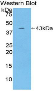 Polyclonal Antibody to Interleukin 12 Receptor Beta 2 (IL12Rb2)