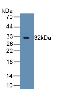 Polyclonal Antibody to Actinin Alpha 3 (ACTN3)